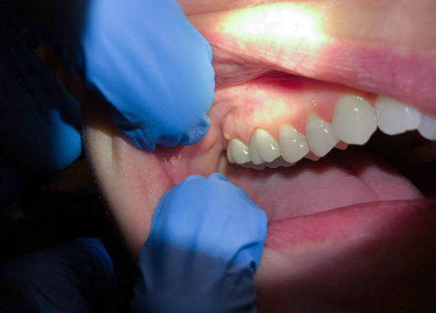 Best Tooth Pain Emergency Relief  in Wacousta, MI