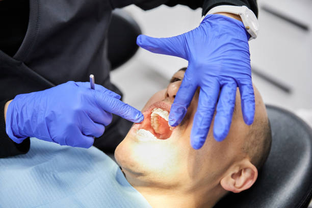 Best Broken Tooth Emergency  in Wacousta, MI